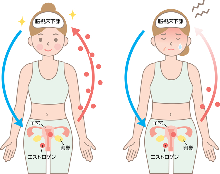 更年期に起こる混乱のイメージ