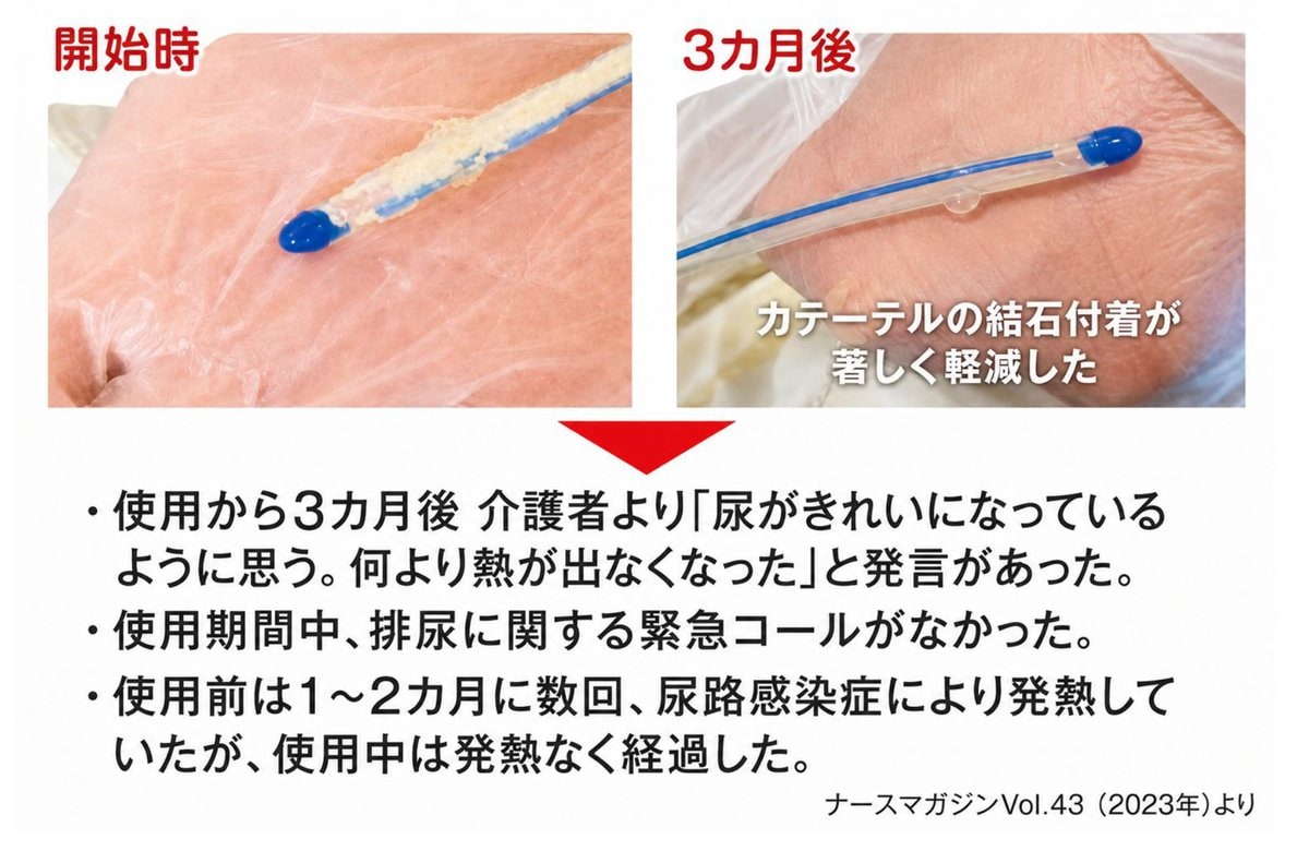在宅での観察例